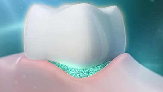 imagem de um dente que explica o funcionamento da tecnologia PRO ARGIN